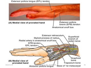 2022/11/16 Dr. Chongo Shapi, BSc. HB, MBChB. 46
 