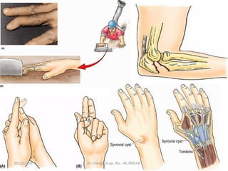 2022/11/16 Dr. Chongo Shapi, BSc. HB, MBChB. 52
 