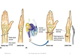 2022/11/16 Dr. Chongo Shapi, BSc. HB, MBChB. 7
 
