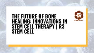 THE FUTURE OF BONE
HEALING: INNOVATIONS IN
STEM CELL THERAPY | R3
STEM CELL
 