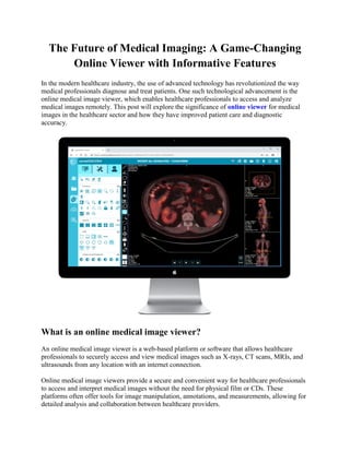 The Future of Medical Imaging: A Game-Changing
Online Viewer with Informative Features
In the modern healthcare industry, the use of advanced technology has revolutionized the way
medical professionals diagnose and treat patients. One such technological advancement is the
online medical image viewer, which enables healthcare professionals to access and analyze
medical images remotely. This post will explore the significance of online viewer for medical
images in the healthcare sector and how they have improved patient care and diagnostic
accuracy.
What is an online medical image viewer?
An online medical image viewer is a web-based platform or software that allows healthcare
professionals to securely access and view medical images such as X-rays, CT scans, MRIs, and
ultrasounds from any location with an internet connection.
Online medical image viewers provide a secure and convenient way for healthcare professionals
to access and interpret medical images without the need for physical film or CDs. These
platforms often offer tools for image manipulation, annotations, and measurements, allowing for
detailed analysis and collaboration between healthcare providers.
 