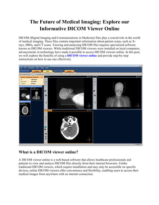 The Future of Medical Imaging: Explore our
Informative DICOM Viewer Online
DICOM (Digital Imaging and Communications in Medicine) files play a crucial role in the world
of medical imaging. These files contain important information about patient scans, such as X-
rays, MRIs, and CT scans. Viewing and analyzing DICOM files requires specialized software
known as DICOM viewers. While traditional DICOM viewers were installed on local computers,
advancements in technology have made it possible to access DICOM viewers online. In this post,
we will explore the benefits of using a DICOM viewer online and provide step-by-step
instructions on how to use one effectively.
What is a DICOM viewer online?
A DICOM viewer online is a web-based software that allows healthcare professionals and
patients to view and analyze DICOM files directly from their internet browsers. Unlike
traditional DICOM viewers, which require installation and may only be accessible on specific
devices, online DICOM viewers offer convenience and flexibility, enabling users to access their
medical images from anywhere with an internet connection.
 