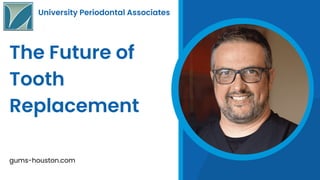University Periodontal Associates
The Future of
Tooth
Replacement
gums-houston.com
 
