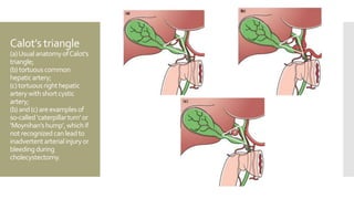 The gallbladder and bile ducts | PPTX