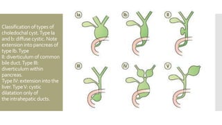 The gallbladder and bile ducts | PPTX