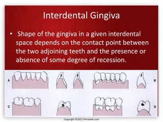 Interdental Gingiva
• Shape of the gingiva in a given interdental
space depends on the contact point between
the two adjoining teeth and the presence or
absence of some degree of recession.
Copyright ©2021 Periowiki.com
 