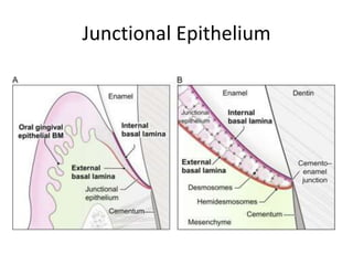 Junctional Epithelium
 