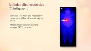 Radiolabelled octreotide
(Scintigraphy)
• involves injection of a radioactive
substance followed by an imaging
scan.
• Occasionally used in locating
ectopic ACTH tumors.
 