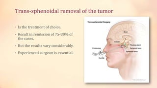 Trans-sphenoidal removal of the tumor
• Is the treatment of choice.
• Result in remission of 75-80% of
the cases.
• But the results vary considerably.
• Experienced surgeon is essential.
 
