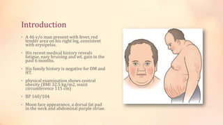 Introduction
• A 46 y/o man present with fever, red
tender area on his right leg, consistent
with erysipelas.
• His recent medical history reveals
fatigue, easy bruising and wt. gain in the
past 6 months.
• His family history is negative for DM and
HT.
• physical examination shows central
obesity (BMI 32.5 kg/m2, waist
circumference 115 cm)
• BP 160/104
• Moon face appearance, a dorsal fat pad
in the neck and abdominal purple striae.
 