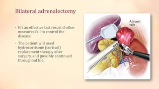 Bilateral adrenalectomy
• It’s an effective last resort if other
measures fail to control the
disease.
• The patient will need
hydrocortisone (cortisol)
replacement therapy after
surgery, and possibly continued
throughout life.
 
