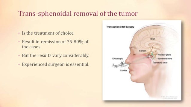 Cushing's syndrome