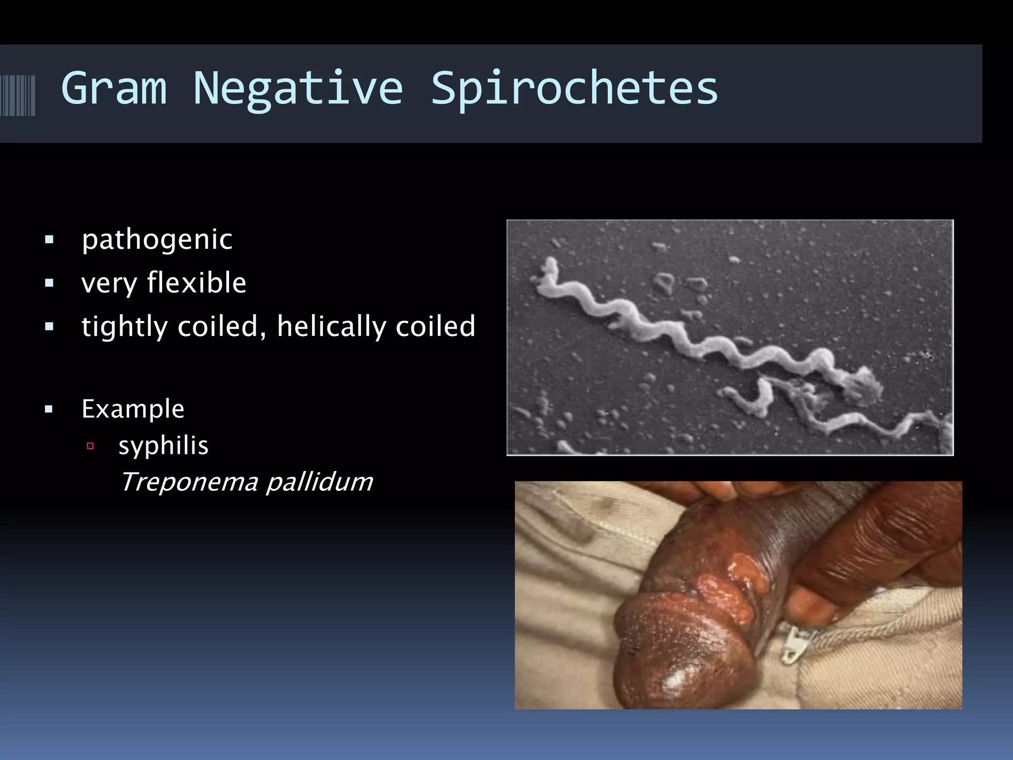 Gram Negative Spirochetes
 pathogenic
 very flexible
 tightly coiled, helically coiled
 Example
 syphilis
Treponema pallidum
 