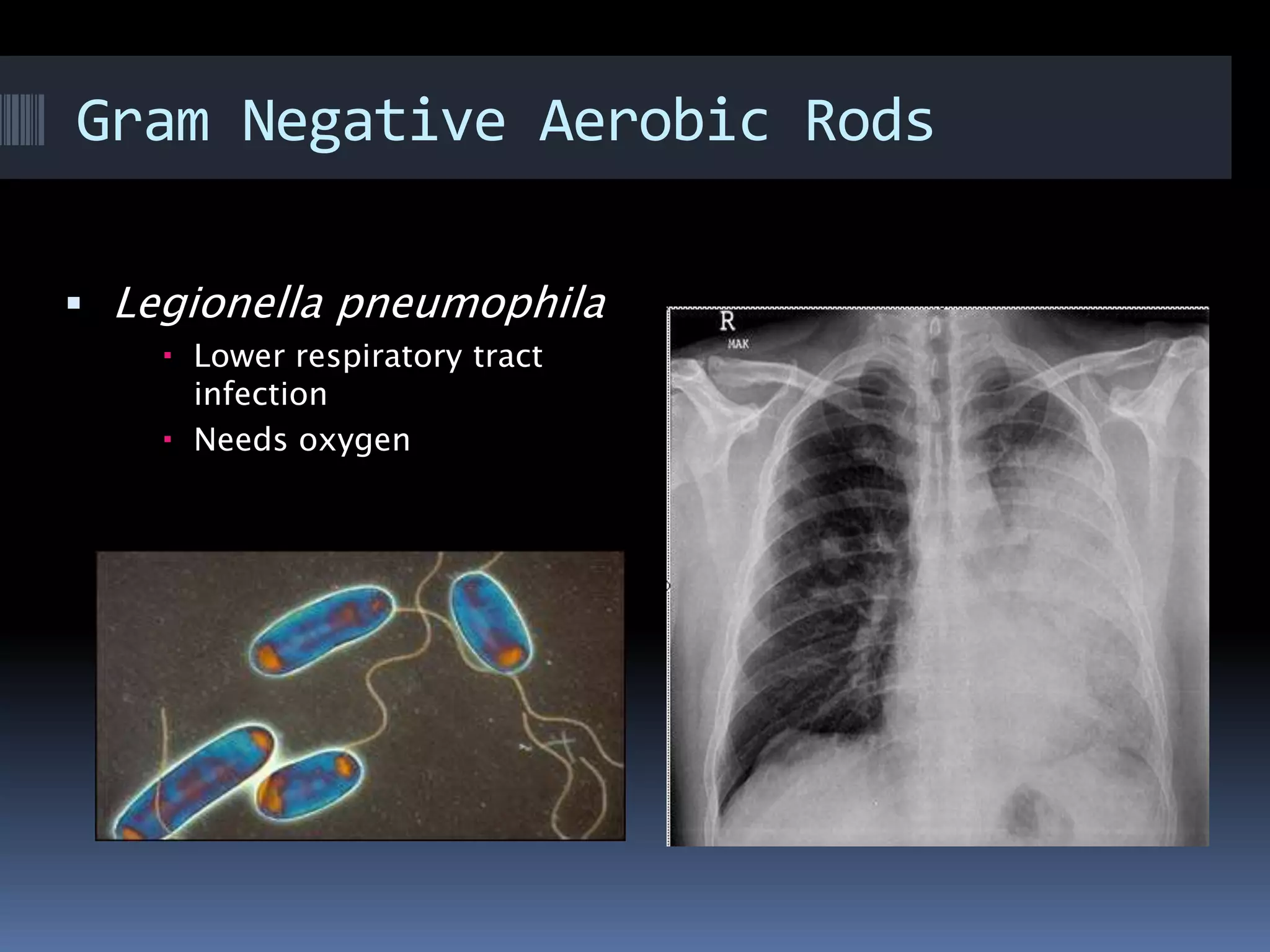 Gram Negative Aerobic Rods
 Legionella pneumophila
 Lower respiratory tract
infection
 Needs oxygen
 