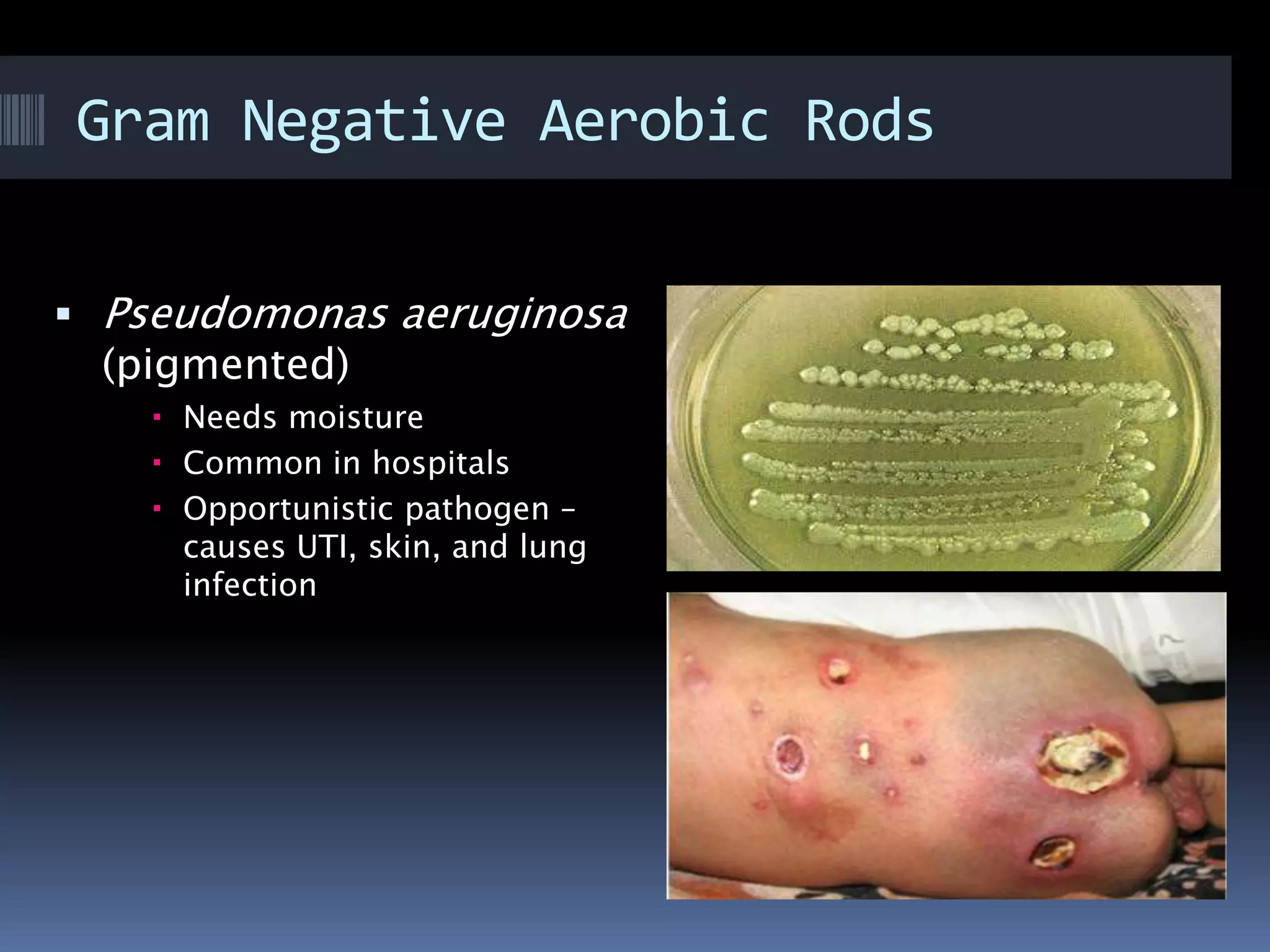 Gram Negative Aerobic Rods
 Pseudomonas aeruginosa
(pigmented)
 Needs moisture
 Common in hospitals
 Opportunistic pathogen –
causes UTI, skin, and lung
infection
 