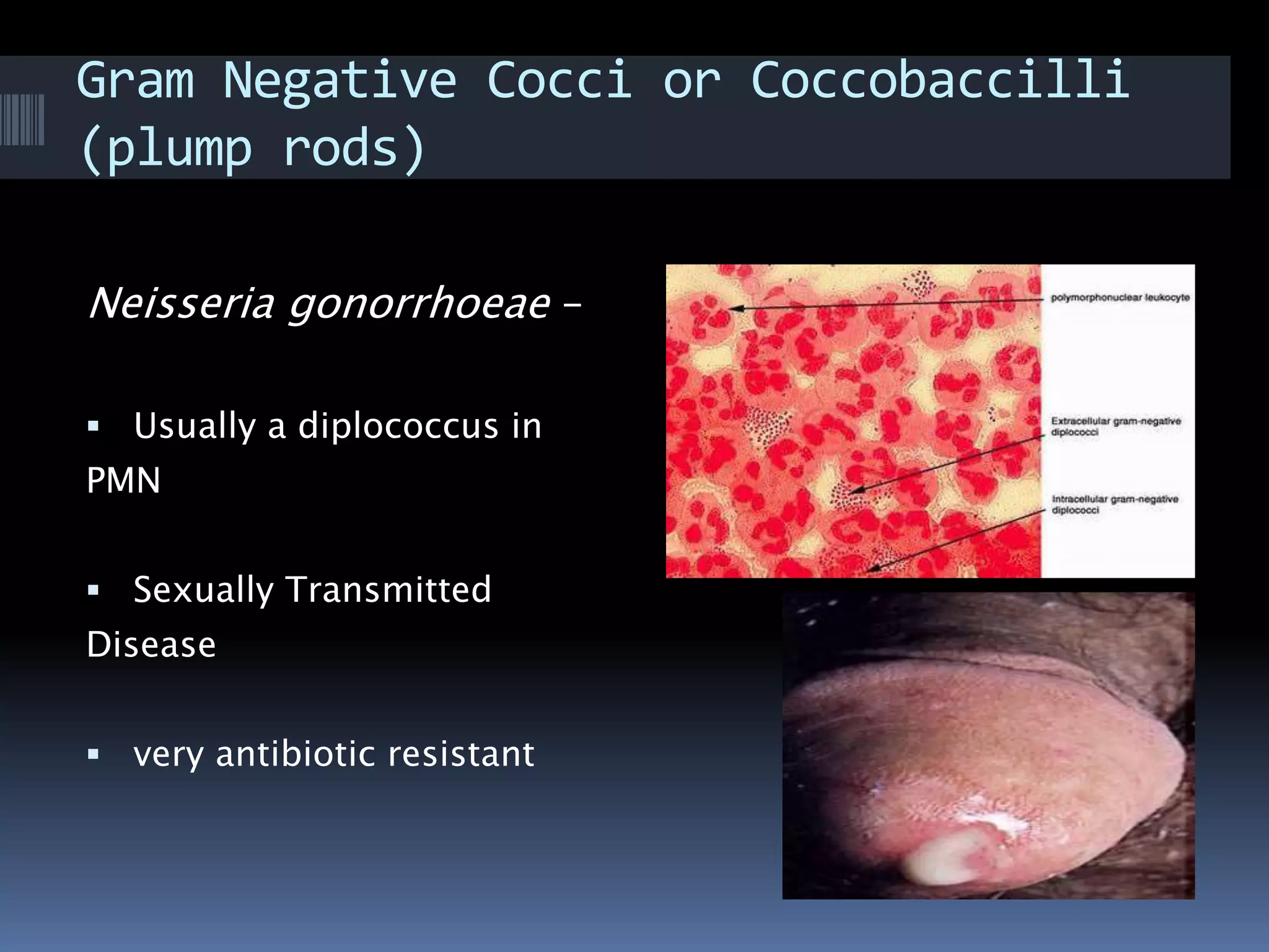 Gram Negative Cocci or Coccobaccilli
(plump rods)
Neisseria gonorrhoeae –
 Usually a diplococcus in
PMN
 Sexually Transmitted
Disease
 very antibiotic resistant
 