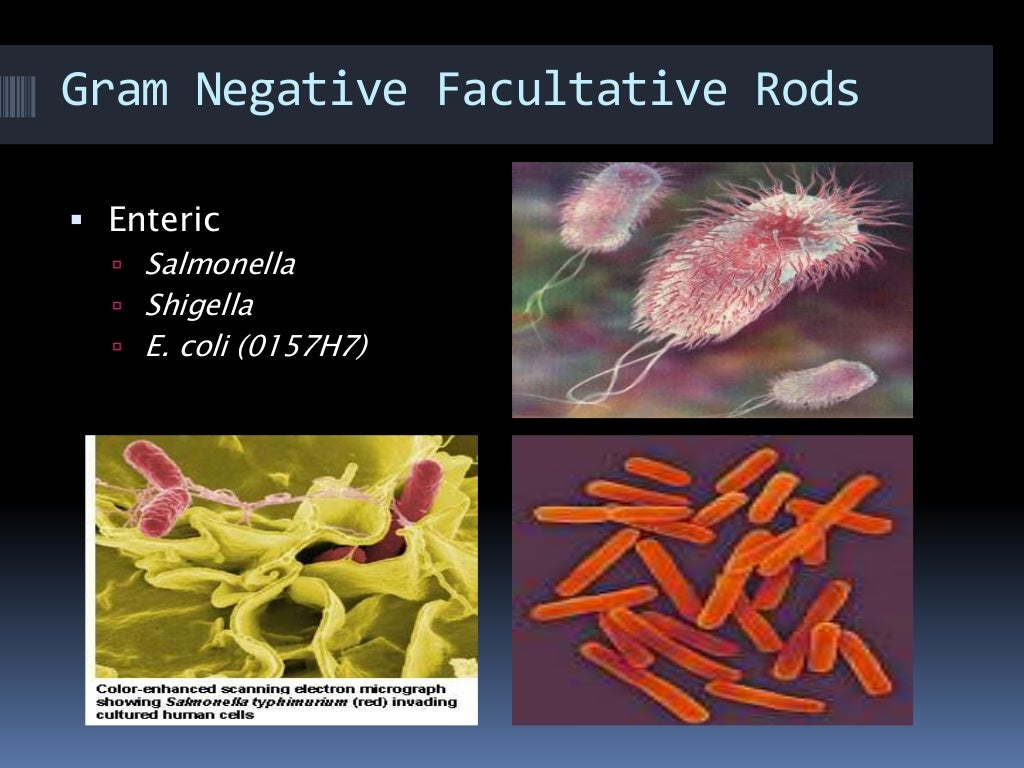 Gram negative bacteria..