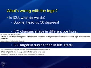 ©2015 MFMER | slide-56
What’s wrong with the logic?
• In ICU, what do we do?
• Supine, head up 30 degrees!
• IVC changes shape in different positions.
• IVC larger in supine than in left lateral.
 