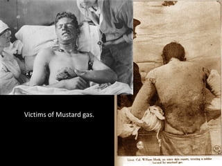 Victims of Mustard gas.
 