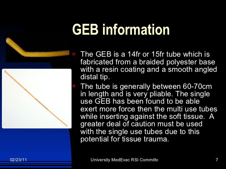 The Gum Elastic Bougie As An Alternative Ett2