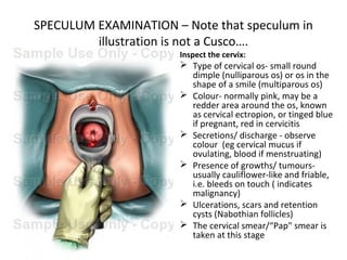 SPECULUM EXAMINATION – Note that speculum in
         illustration is not a Cusco….
                       Inspect the cervix:
                        Type of cervical os- small round
                         dimple (nulliparous os) or os in the
                         shape of a smile (multiparous os)
                        Colour- normally pink, may be a
                         redder area around the os, known
                         as cervical ectropion, or tinged blue
                         if pregnant, red in cervicitis
                        Secretions/ discharge - observe
                         colour (eg cervical mucus if
                         ovulating, blood if menstruating)
                        Presence of growths/ tumours-
                         usually cauliflower-like and friable,
                         i.e. bleeds on touch ( indicates
                         malignancy)
                        Ulcerations, scars and retention
                         cysts (Nabothian follicles)
                        The cervical smear/“Pap" smear is
                         taken at this stage
 