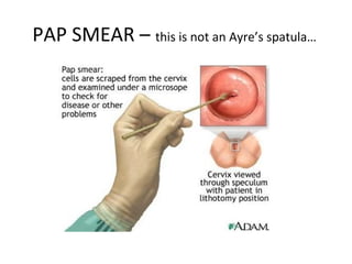 PAP SMEAR – this is not an Ayre’s spatula…
 