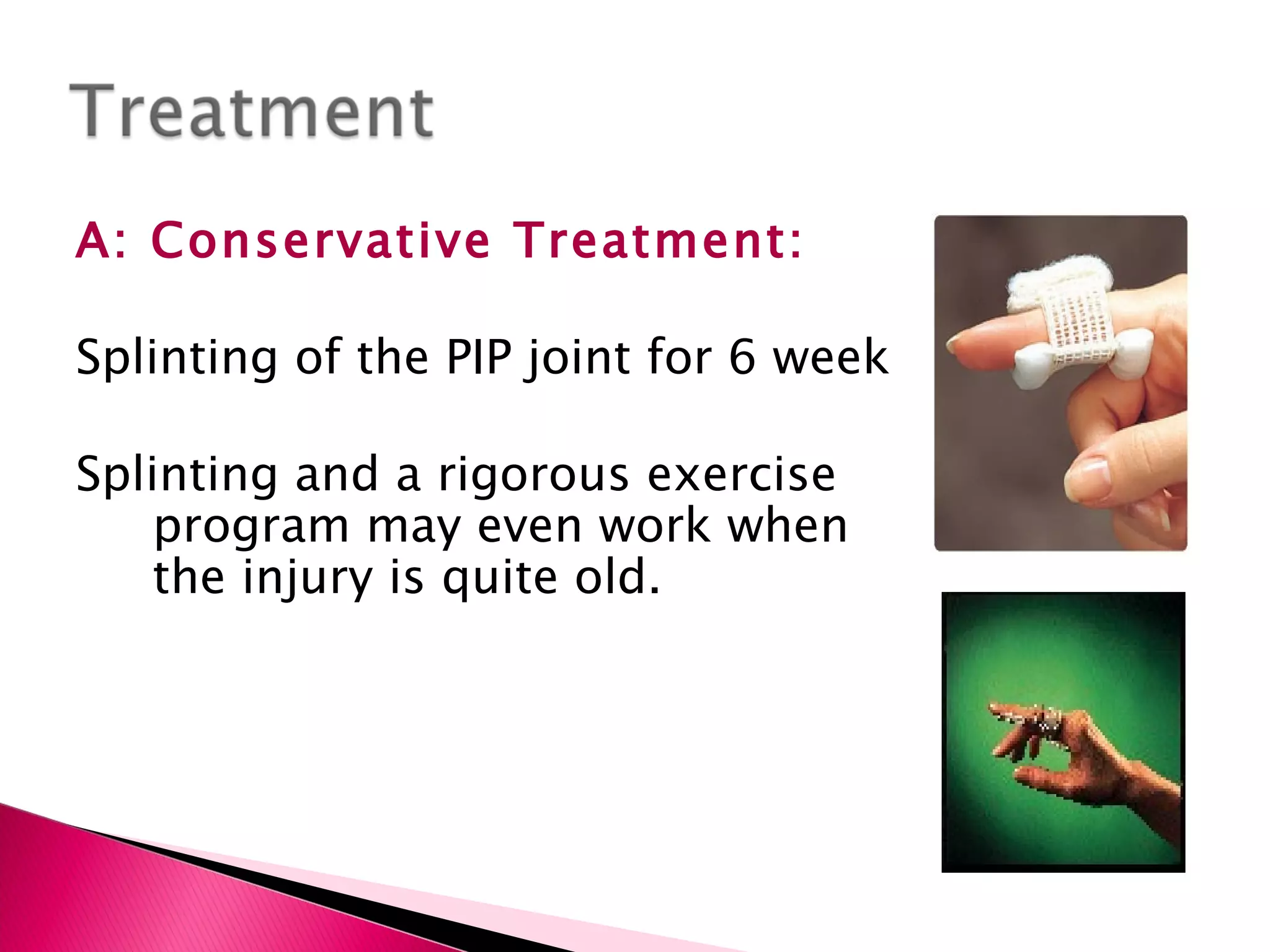 A: Conservative Treatment: Splinting of the PIP joint for 6 week Splinting and a rigorous exercise program may even work when the injury is quite old. 