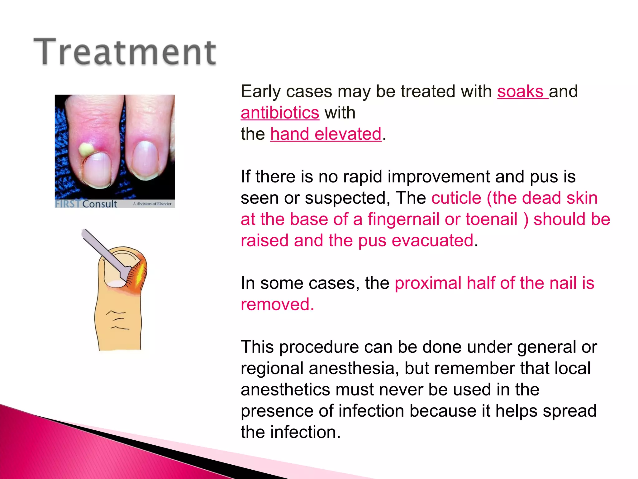 Early cases may be treated with  soaks  and  antibiotics  with  the  hand elevated . If there is no rapid improvement and pus is seen or suspected, The  cuticle (the dead skin at the base of a fingernail or toenail ) should be raised and the pus evacuated . In some cases, the  proximal half of the nail is removed. This procedure can be done under general or regional anesthesia, but remember that local anesthetics must never be used in the presence of infection because it helps spread the infection. 