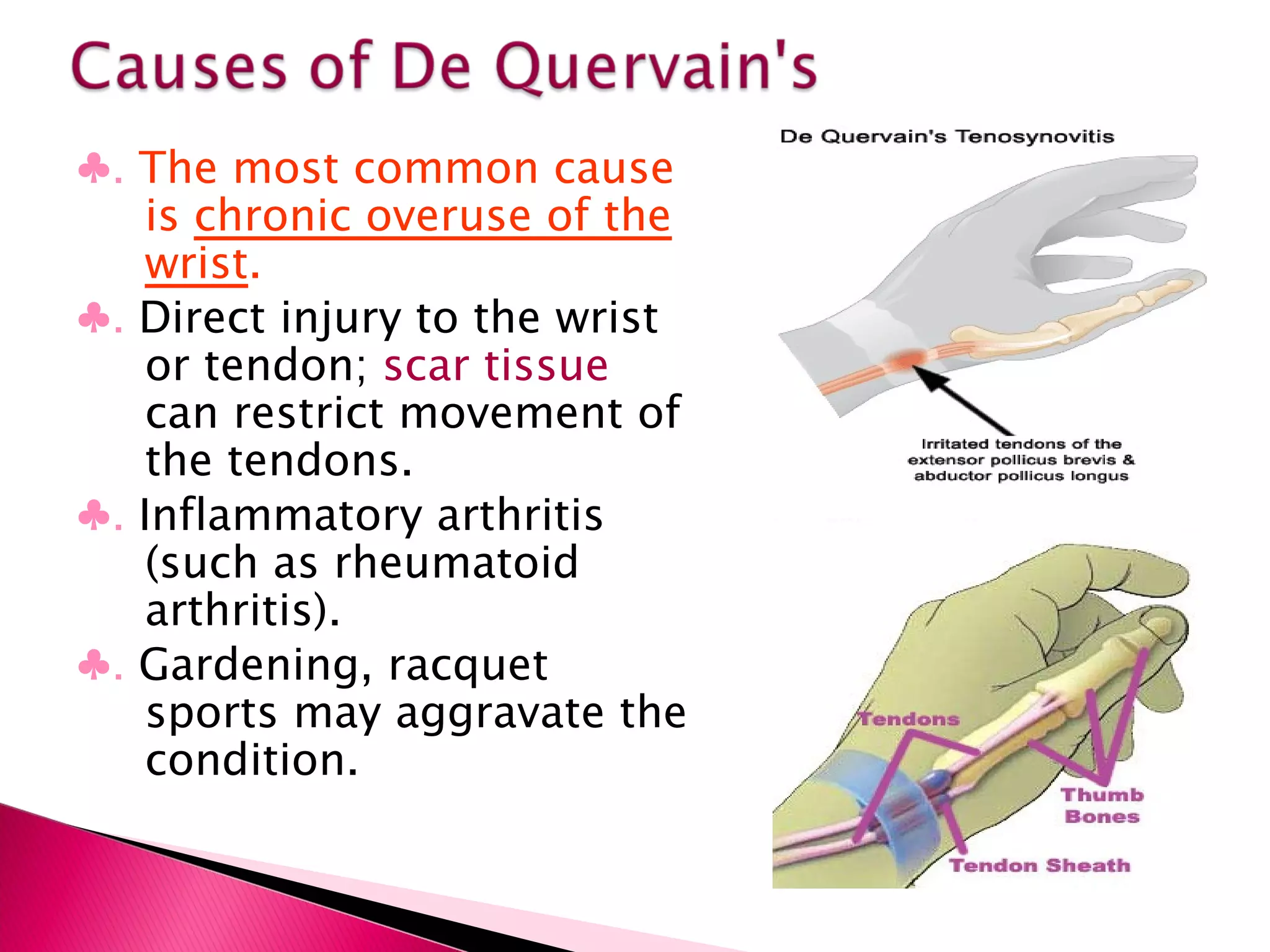 ♣ .  The most common cause is  chronic overuse of the wrist .  ♣ .  Direct injury to the wrist or tendon;  scar tissue  can restrict movement of the tendons. ♣ .  Inflammatory arthritis (such as rheumatoid arthritis). ♣ .  Gardening, racquet sports may aggravate the condition. 