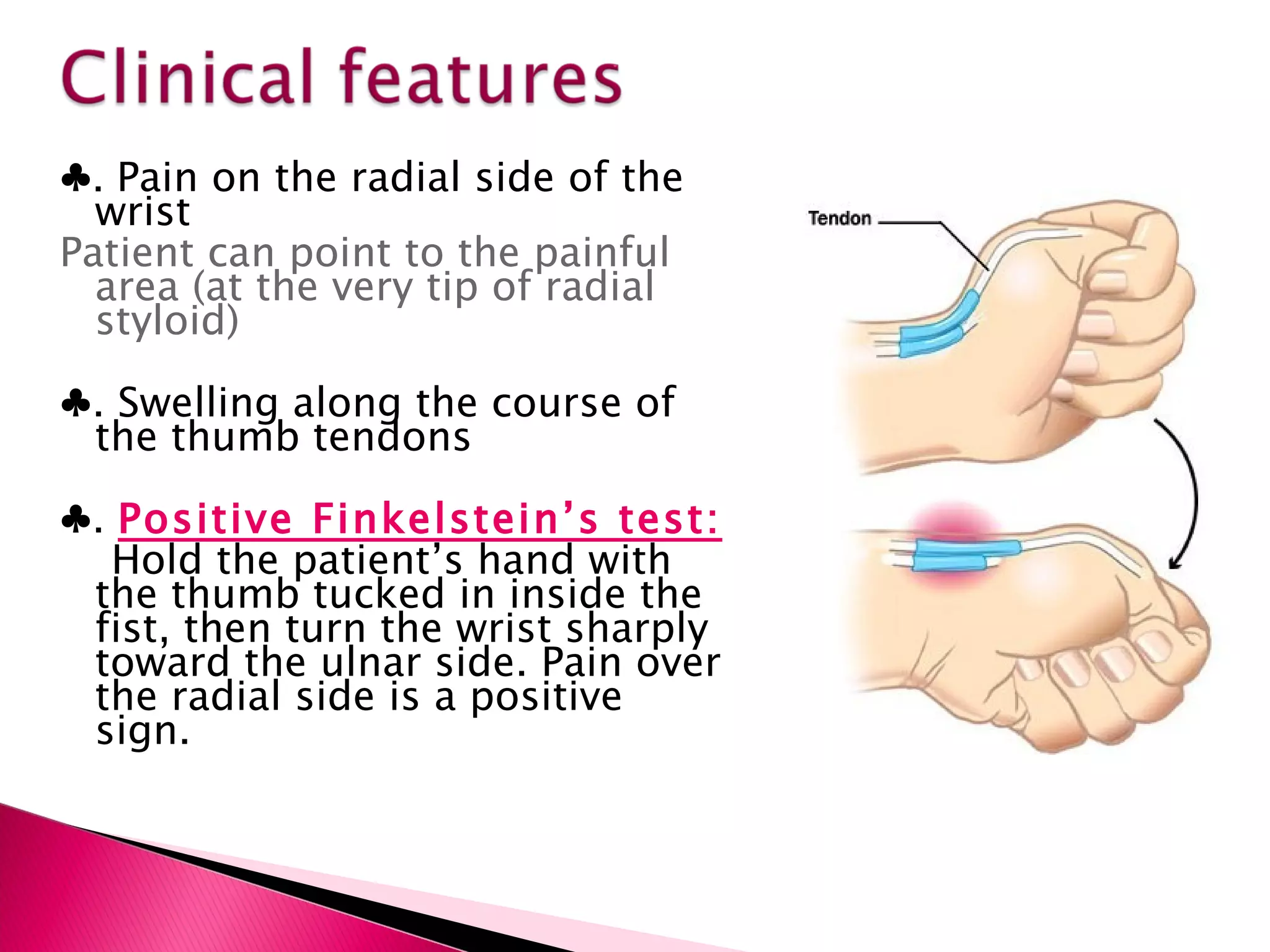 ♣ .  Pain on the radial side of the wrist Patient can point to the painful area (at the very tip of radial styloid)  ♣ . Swelling along the course of the thumb tendons ♣ .  Positive Finkelstein’s test: Hold the patient’s hand with the thumb tucked in inside the fist, then turn the wrist sharply toward the ulnar side. Pain over the radial side is a positive sign.  