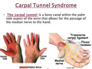 The carpal tunnel   is a bony canal within the palm side aspect of the wrist that allows for the passage of the median nerve to the hand.  