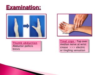 Tinel sign  : Tap over median nerve at wrist crease  >>> electric or tingling sensation Examination: Thumb abduction Abductor pollicis brevis 
