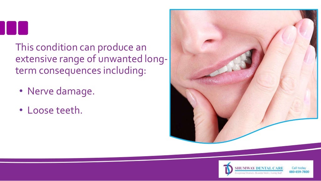 The Harmful Effects Of Teeth Grinding