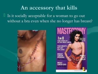 An accessory that kills
 Is it socially acceptable for a woman to go out
without a bra even when she no longer has breast?
 