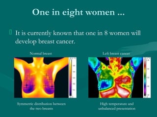 One in eight women ...
 It is currently known that one in 8 women will
develop breast cancer.
High temperature and
unbala...