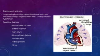 • Eisenmenger's syndrome:
• long-standing left-to-right cardiac shunt in interventricular
septum caused by a congenital heart defect causes pulmonary
hypertension
• Result into- Cyanosis
-High red blood cell count
-clubbed finger tips
-Heart failure
-Abnormal heart rhythms
-Iron deficiency
-Kidney problems
-Stroke
 