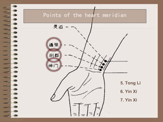 Li Yinxi The heart meridian | PPTX