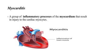 Myocarditis
- A group of inflammatory processes of the myocardium that result
in injury to the cardiac myocytes.
 