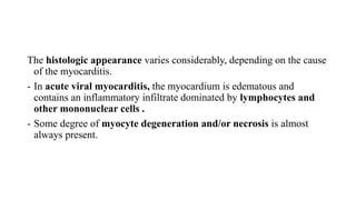 The histologic appearance varies considerably, depending on the cause
of the myocarditis.
- In acute viral myocarditis, the myocardium is edematous and
contains an inflammatory infiltrate dominated by lymphocytes and
other mononuclear cells .
- Some degree of myocyte degeneration and/or necrosis is almost
always present.
 
