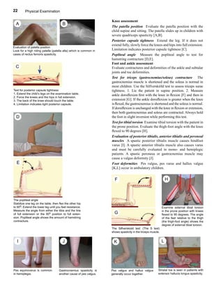Ue Extensor Spasticity Positioning The help guide to cerebral palsy 2ed | PDF