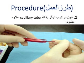Procedure( (طرزالعمل 
علاوه capillary tube 2. خون در تیوب دیگر به نام 
میشود. 
 