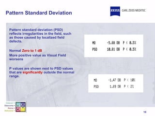 Pattern Standard Deviation Pattern standard deviation (PSD) reflects irregularities in the field, such as those caused by localized field defects.  Normal  Zero to 1 dB More positive value as Visual Field worsens P values are shown next to PSD values that are  significantly  outside the normal range. 