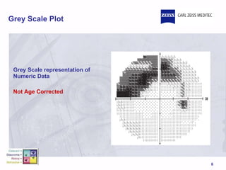 Grey Scale Plot Grey Scale representation of Numeric Data Not Age Corrected 