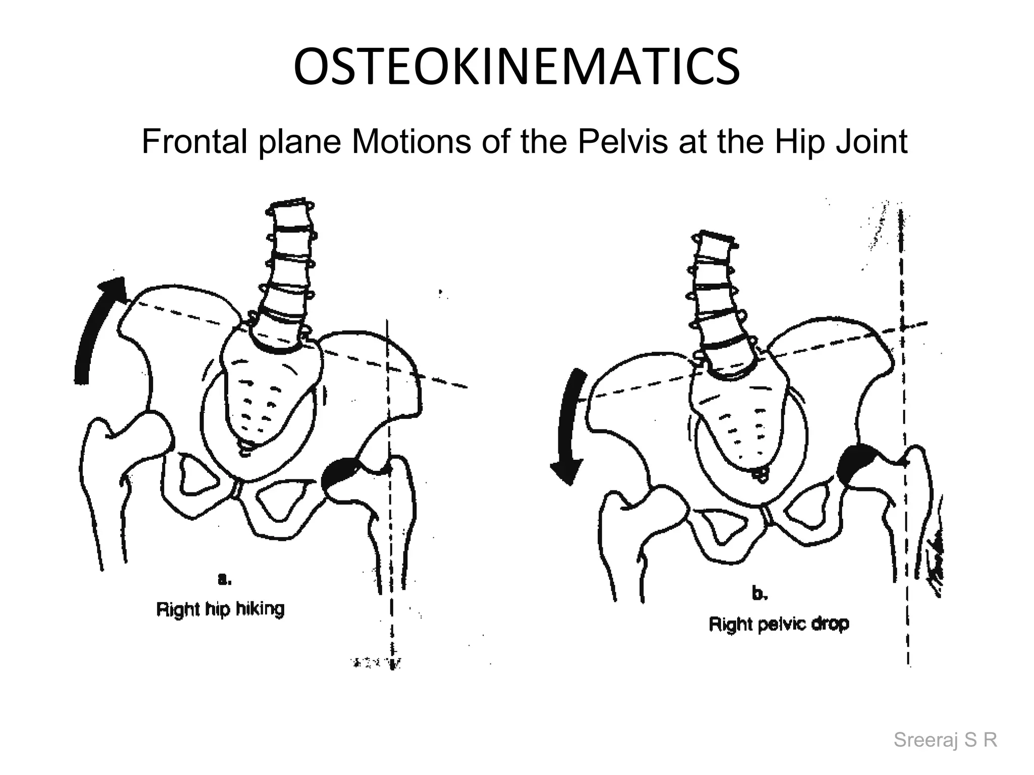 OSTEOKINEMATICS
Frontal plane Motions of the Pelvis at the Hip Joint




                                                   Sreeraj S R
 