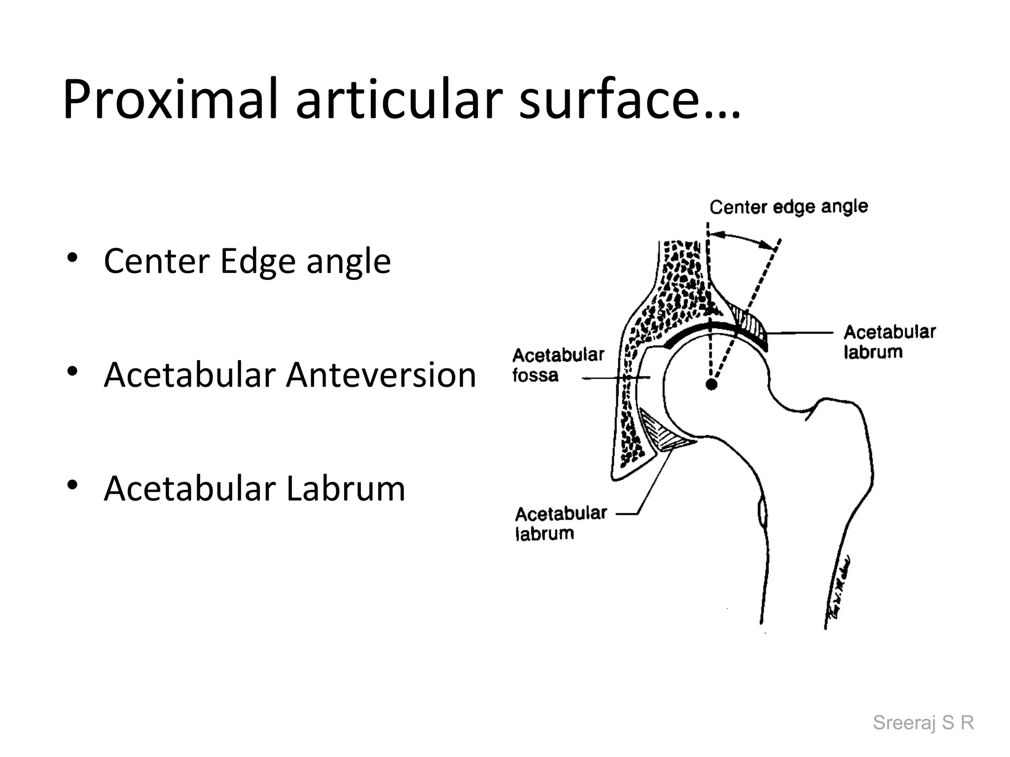 Proximal articular surface…

• Center Edge angle

• Acetabular Anteversion

• Acetabular Labrum




                              Sreeraj S R
 