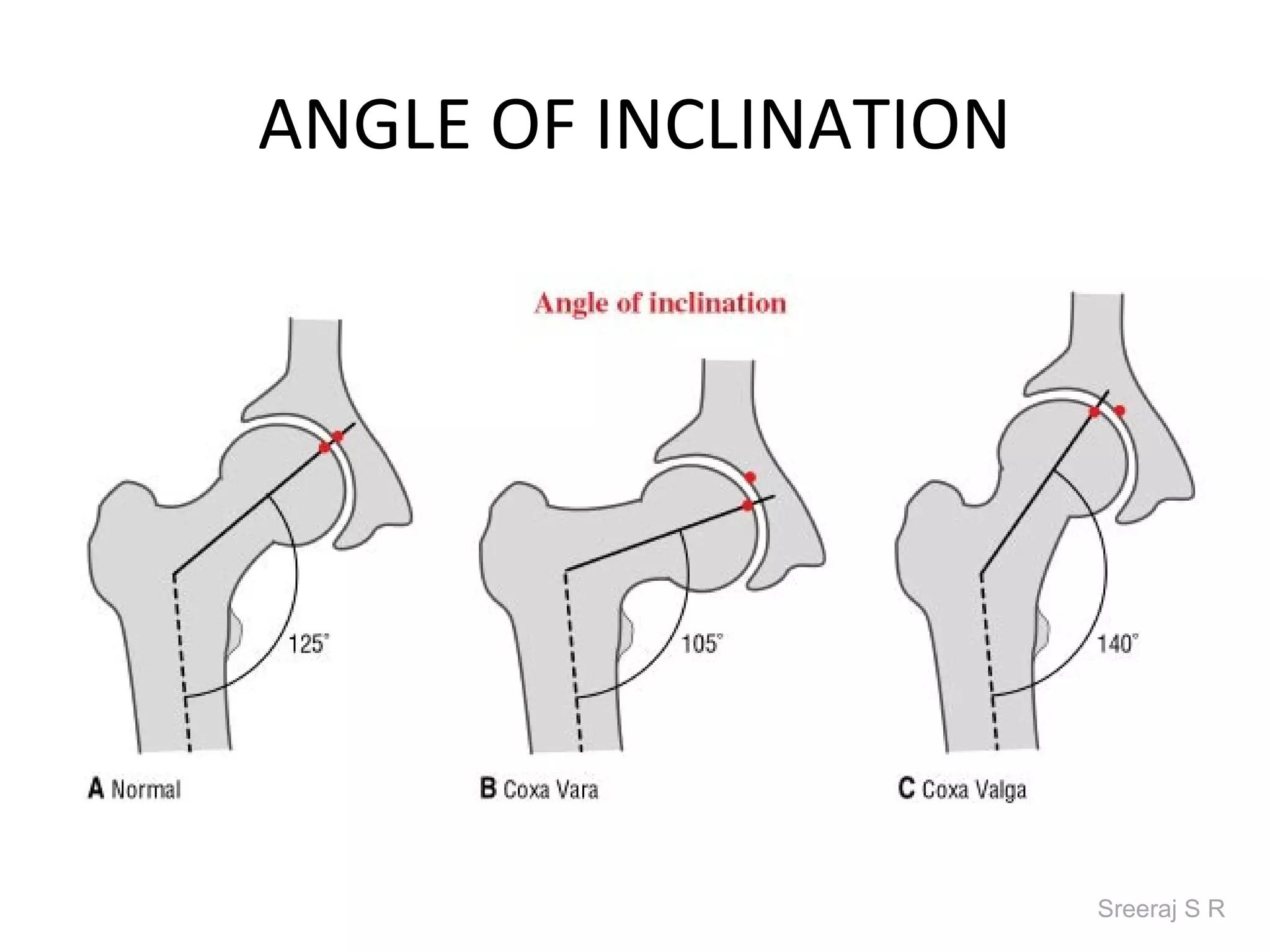 ANGLE OF INCLINATION




                       Sreeraj S R
 