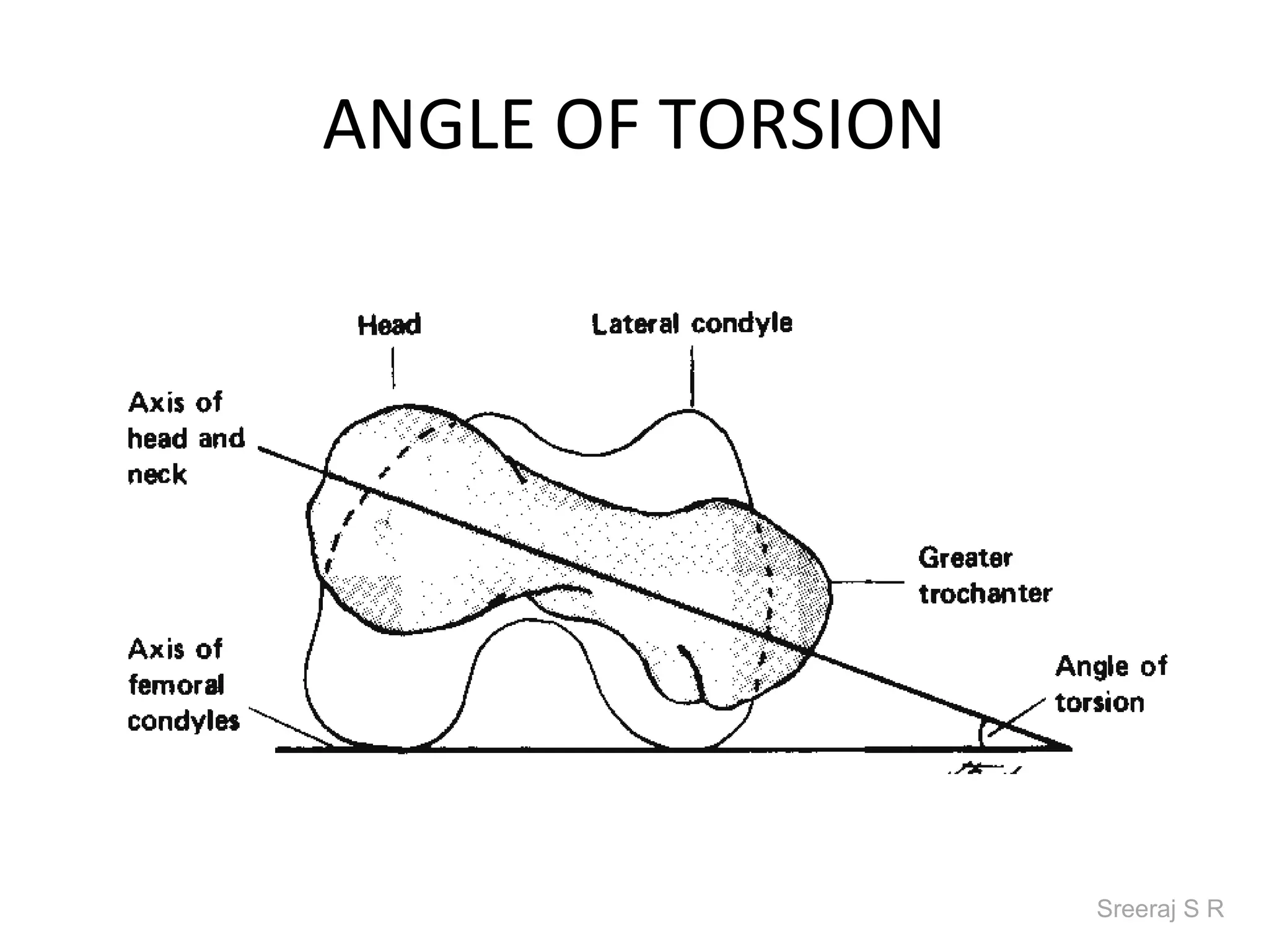 ANGLE OF TORSION




                   Sreeraj S R
 