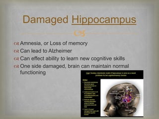 Damaged Hippocampus 
 
 Amnesia, or Loss of memory 
 Can lead to Alzheimer 
 Can effect ability to learn new cognitive skills 
 One side damaged, brain can maintain normal 
functioning 
