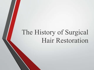 The History of Surgical
Hair Restoration
 