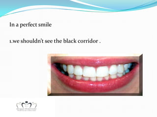 In a perfect smile

1.we shouldn’t see the black corridor .
 